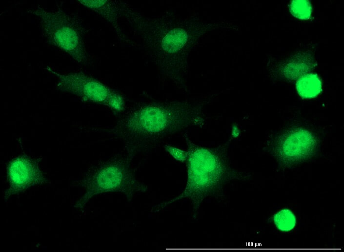 An Enzyme‐Directed Imidazoquinoline for Cancer Immunotherapy